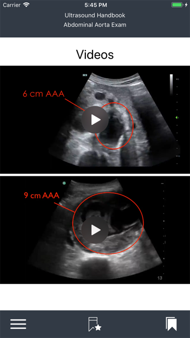 Emergency Ultrasound Handbook screenshot