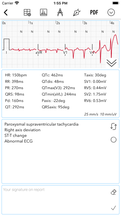 ECG Pro for Doctors screenshot