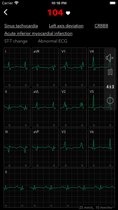 ECG Pro for Doctors screenshot