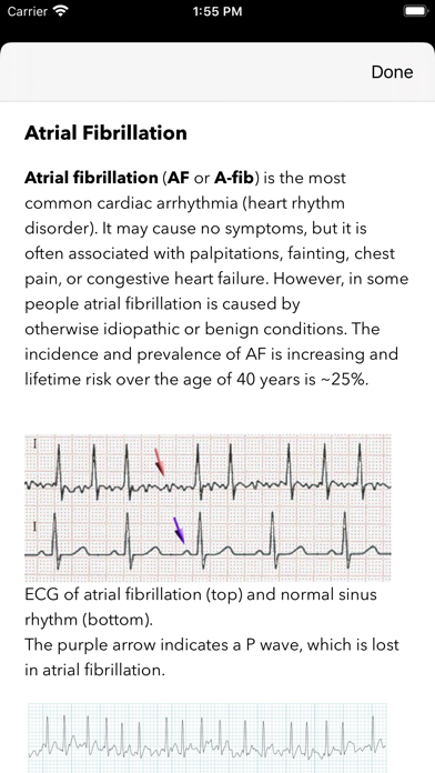 ECG Pro for Doctors screenshot