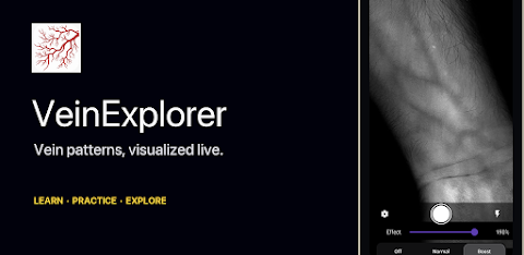 VeinExplorer: Vein Visualizer screenshot