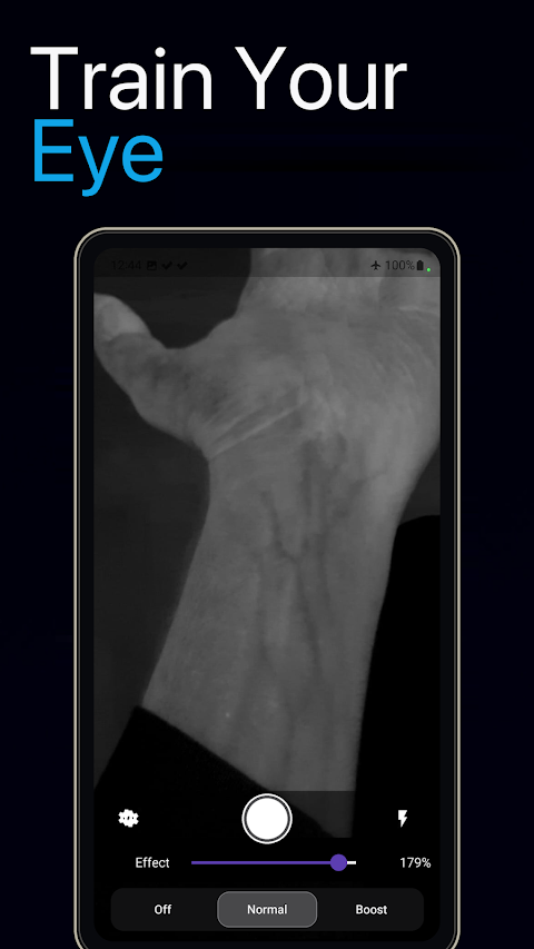 VeinExplorer: Vein Visualizer screenshot
