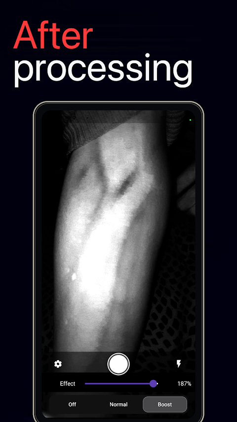 VeinExplorer: Vein Visualizer screenshot